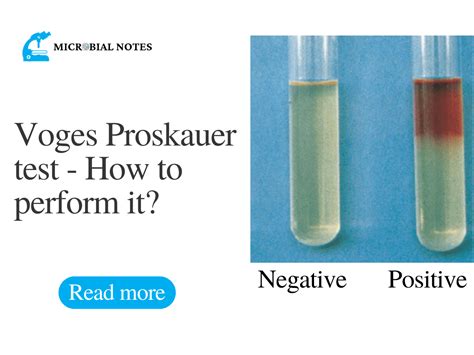 voges proskauer test reaction|Voges Proskauer Test .